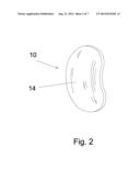 SHOULDER INTER-SPACER COMPONENT AND SURGICAL METHOD OF IMPLANTATION diagram and image