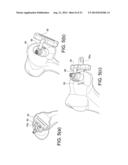 METHODS AND INSTRUMENTS FOR FORMING NON-CIRCULAR CARTILAGE GRAFTS diagram and image