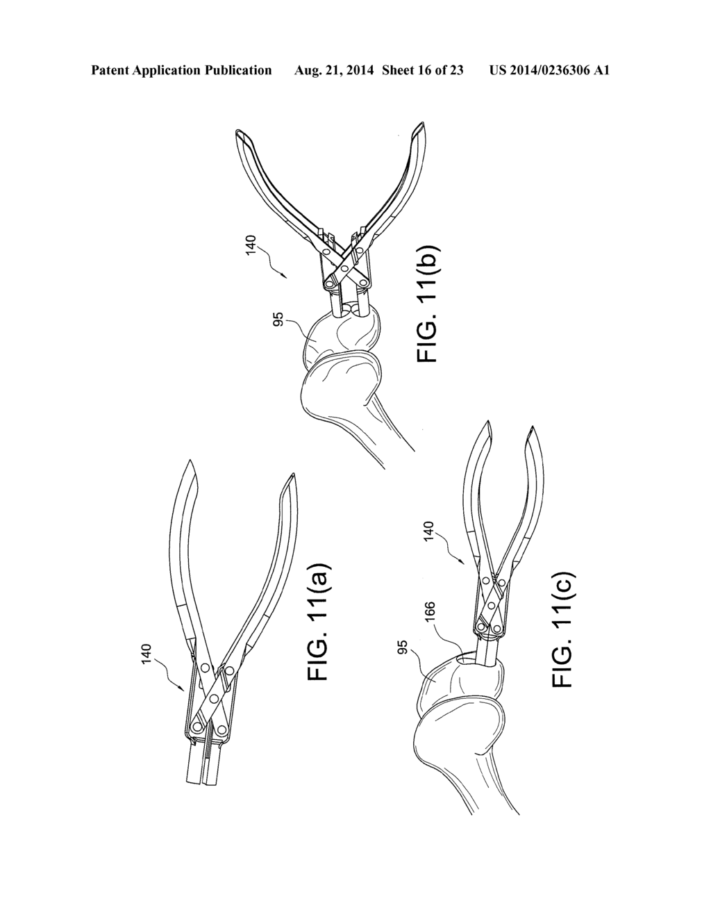 METHODS AND INSTRUMENTS FOR FORMING NON-CIRCULAR CARTILAGE GRAFTS - diagram, schematic, and image 17