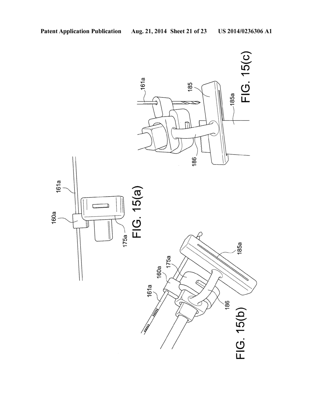 METHODS AND INSTRUMENTS FOR FORMING NON-CIRCULAR CARTILAGE GRAFTS - diagram, schematic, and image 22