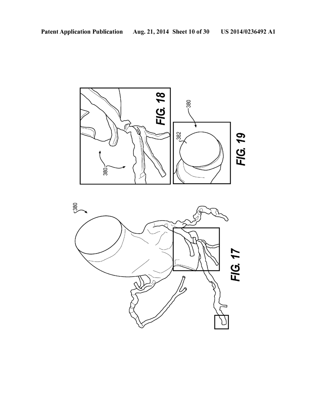 METHOD AND SYSTEM FOR PATIENT-SPECIFIC MODELING OF BLOOD FLOW - diagram, schematic, and image 11