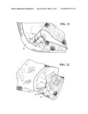 OUTERWEAR SYSTEM INCORPORATING A BASE GARMENT WITH ATTACHABLE OUTER SKINS,     SUCH AS FOR PROVIDING TERRAIN DICTATED CAMOUFLAGE diagram and image