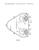 Backflush Filter Cleaning System and Method of Use diagram and image