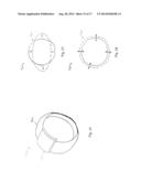 Method and Apparatus for a Flexible Housing diagram and image