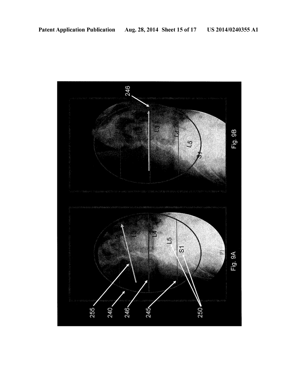 Imaging System and Method for Use in Surgical and Interventional Medical     Procedures - diagram, schematic, and image 16