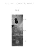 APPARATUS AND METHOD FOR LESION SEGMENTATION IN MEDICAL IMAGE diagram and image