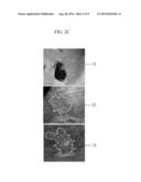 APPARATUS AND METHOD FOR LESION SEGMENTATION IN MEDICAL IMAGE diagram and image