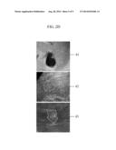 APPARATUS AND METHOD FOR LESION SEGMENTATION IN MEDICAL IMAGE diagram and image