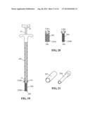 Devices and methods for treating defects in the tissue of a living being diagram and image