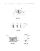 Devices and methods for treating defects in the tissue of a living being diagram and image