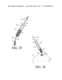 Devices and methods for treating defects in the tissue of a living being diagram and image