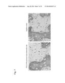 CARTILAGE/BONE DESTRUCTION SUPPRESSOR diagram and image