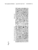 CARTILAGE/BONE DESTRUCTION SUPPRESSOR diagram and image