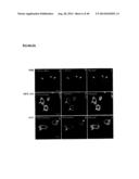 VHZ FOR DIAGNOSIS AND TREATMENT OF CANCER diagram and image