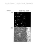 VHZ FOR DIAGNOSIS AND TREATMENT OF CANCER diagram and image