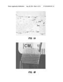 ADIPOSE STROMAL VASCULAR FRACTION CELL CONSTRUCTS diagram and image