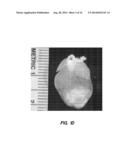 ADIPOSE STROMAL VASCULAR FRACTION CELL CONSTRUCTS diagram and image