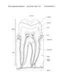 FLUORIDE RELEASING BITE PLATE diagram and image