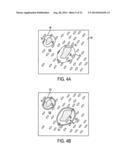 Laser Microdissection Method and Apparatus diagram and image