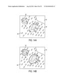 Laser Microdissection Method and Apparatus diagram and image