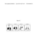 CYSTIC FIBROSIS TREATMENT diagram and image