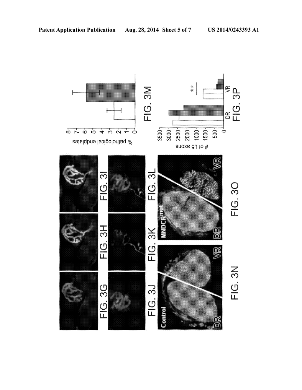 METHODS OF DIAGNOSING AND TREATING MOTOR NEURON DISEASES - diagram, schematic, and image 06