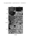 COMPOUNDS INHIBITING GALECTIN-1 EXPRESSION, CANCER CELL PROLIFERATION,     INVASION, AND TUMORIGENESIS diagram and image