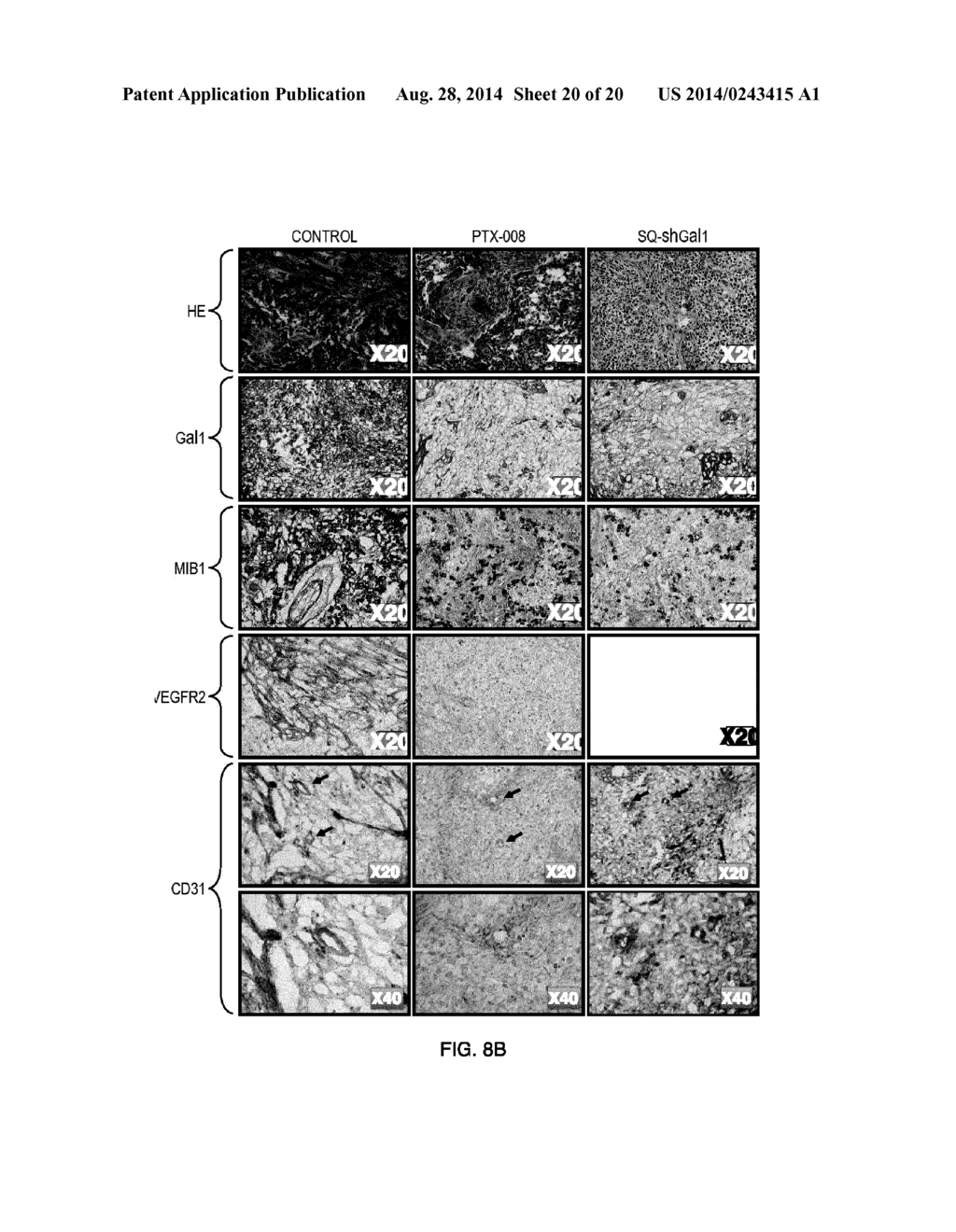 COMPOUNDS INHIBITING GALECTIN-1 EXPRESSION, CANCER CELL PROLIFERATION,     INVASION, AND TUMORIGENESIS - diagram, schematic, and image 21