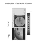 HYDROPHILICITY ALTERATION SYSTEM AND METHOD diagram and image