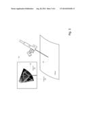 Computer-Implemented Technique for Calculating a Position of a Surgical     Device diagram and image