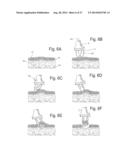 FRICTIONAL TRANS-EPITHELIAL TISSUE DISRUPTION COLLECTION APPARATUS AND     METHOD OF INDUCING AN IMMUNE RESPONSE diagram and image