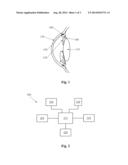 INTRAOCULAR PRESSURE SENSOR WITH EXTERNAL PRESSURE COMPENSATION diagram and image