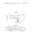 INTERVENTIONAL CATHETER HOUSING ASSEMBLIES INCORPORATING GUIDE WIRE BRAKES     AND MANAGEMENT SYSTEMS diagram and image