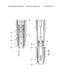 Needle Sheath Remover Assembly diagram and image