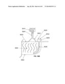 CONTROLLED NEGATIVE PRESSURE APPARATUS AND ALARM MECHANISM diagram and image