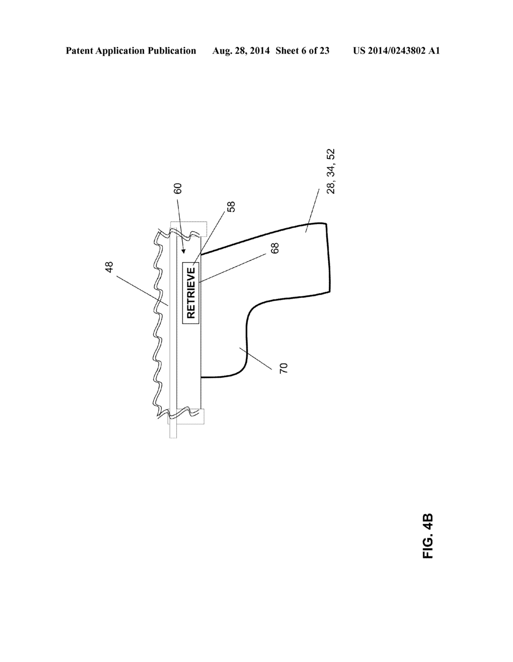 RELEASE DEVICE FOR DETACHING A MEDICAL IMPLANT FROM AN INSERTION DEVICE     AND AN INSERTION DEVICE COMPRISING A RELEASE DEVICE - diagram, schematic, and image 07