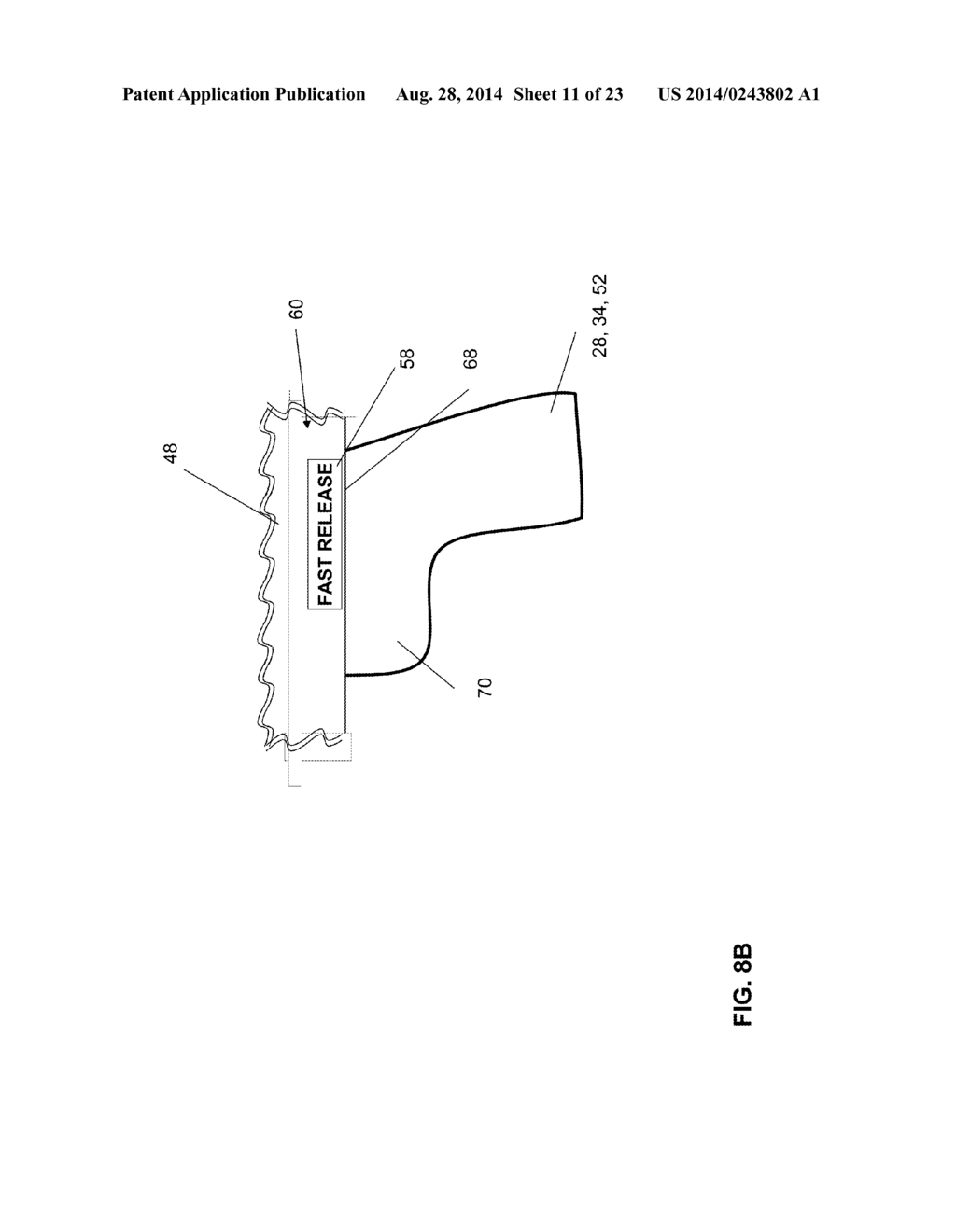 RELEASE DEVICE FOR DETACHING A MEDICAL IMPLANT FROM AN INSERTION DEVICE     AND AN INSERTION DEVICE COMPRISING A RELEASE DEVICE - diagram, schematic, and image 12