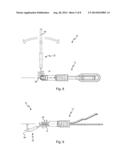 Medical Instrument Having A Corkscrew-like Connection Element diagram and image