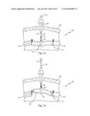 Medical Instrument Having A Corkscrew-like Connection Element diagram and image