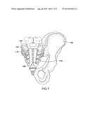 Methods of Treating the Sacroiliac Region of a Patient s Body diagram and image