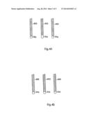 Methods of Treating the Sacroiliac Region of a Patient s Body diagram and image