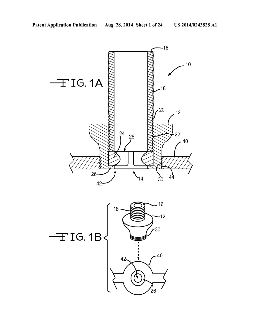 Orthopaedic Device - diagram, schematic, and image 02