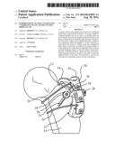 Periprosthetic Plating System with Compressive Plate and Transverse Bridge     Plate diagram and image