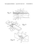 Periprosthetic Plating System with Compressive Plate and Transverse Bridge     Plate diagram and image