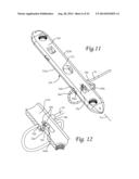 Periprosthetic Plating System with Compressive Plate and Transverse Bridge     Plate diagram and image