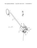 Periprosthetic Plating System with Compressive Plate and Transverse Bridge     Plate diagram and image