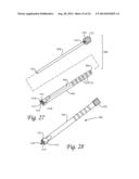 Periprosthetic Plating System with Compressive Plate and Transverse Bridge     Plate diagram and image