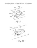 Periprosthetic Plating System with Compressive Plate and Transverse Bridge     Plate diagram and image