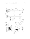 Periprosthetic Plating System with Compressive Plate and Transverse Bridge     Plate diagram and image