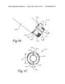 Periprosthetic Plating System with Compressive Plate and Transverse Bridge     Plate diagram and image